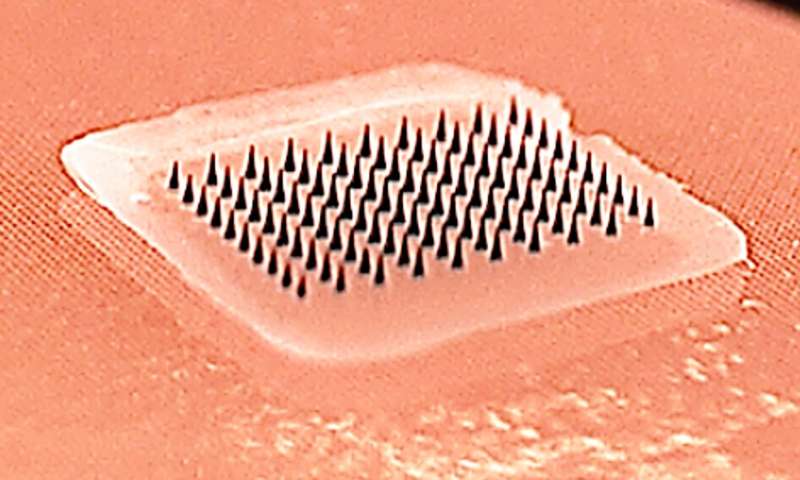 microneedle patch https://medicalxpress.com/