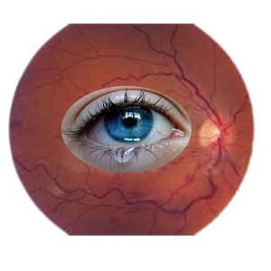eye stroke