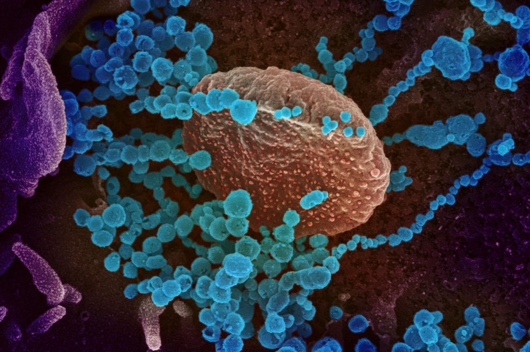 Bacteria and Virus