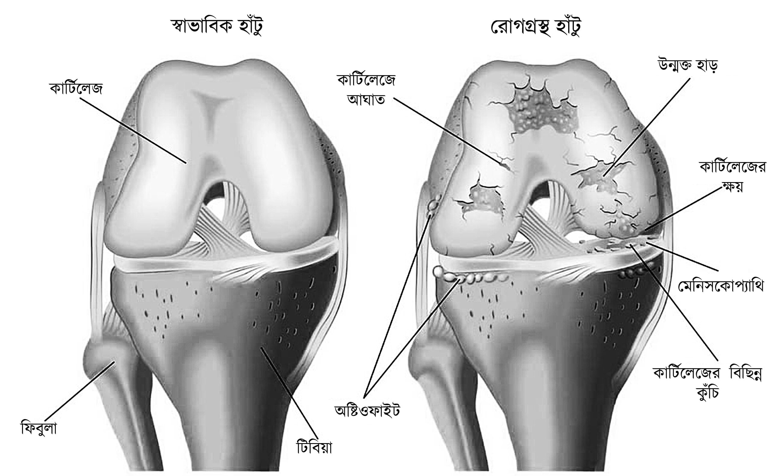 knee pain illustration