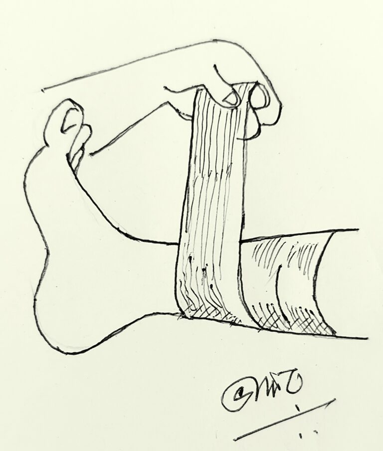 crepe bandage in injured body part